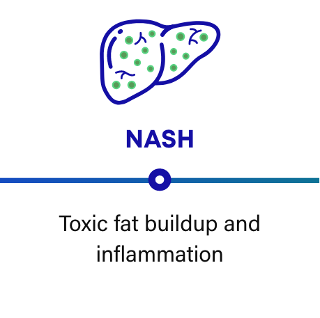 How NASH progresses: NASH can cause toxic buildup and inflammation